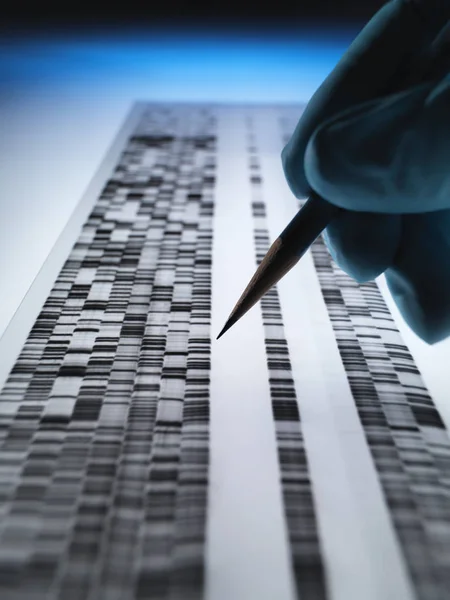 Επιστήμονας Προβολή Πηκτωμάτων Dna Που Χρησιμοποιούνται Στη Γενετική Ιατροδικαστική Pharma — Φωτογραφία Αρχείου