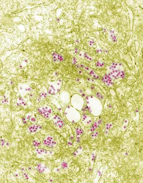 Scanning Electron Micrograph Russian Spring Summer Encephalitis — Stock Photo, Image