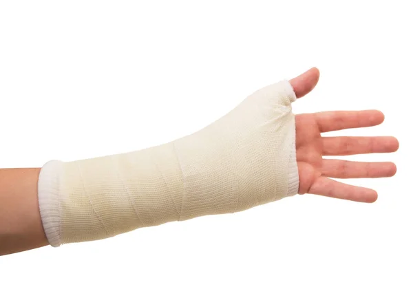 Arm in gips op witte achtergrond — Stockfoto