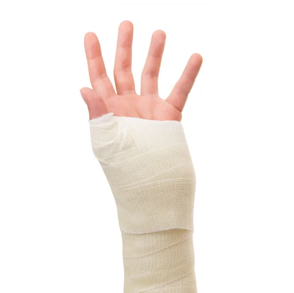 Arm in gips op witte achtergrond — Stockfoto