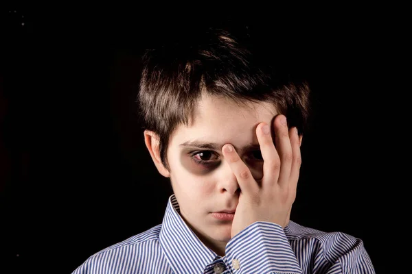 Boy with black eye — Stock Photo, Image