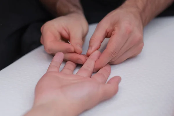 Main Des Médecins Effectuent Traitement Acupuncture Professionnel Médical Dans Spa — Photo
