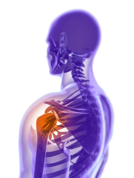 Shoulder joint pain and discomfort — Stock Photo, Image