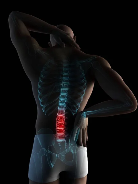 Lokalizacja bólu w sekcji kręgosłupa z powrotem — Zdjęcie stockowe