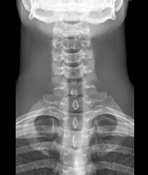 Cervical spine anatomy — Stock Photo, Image