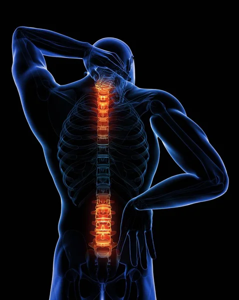 Localización del dolor de espalda en la sección espinal — Foto de Stock