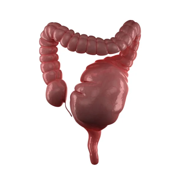 Megacolon congenito o acquisito — Foto Stock