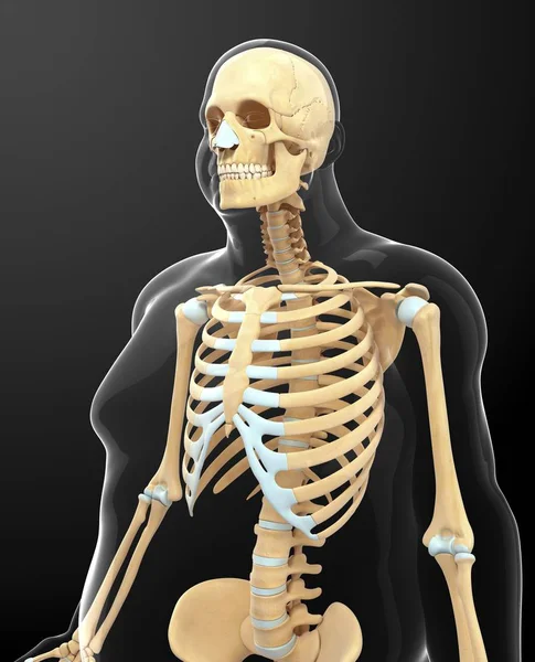 肥胖的人的骨骼系统 — 图库照片