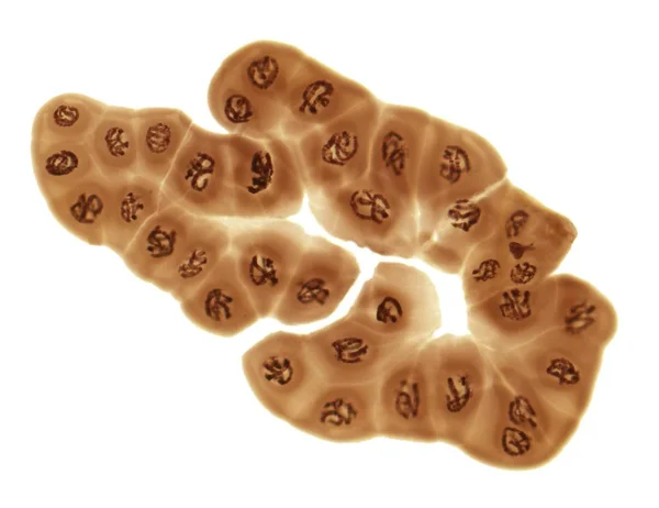 Гігантський Polytene хромосом — стокове фото