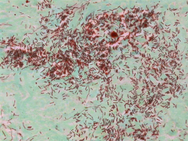 Liczby komórek agregowania w miejscu zakażenia — Zdjęcie stockowe
