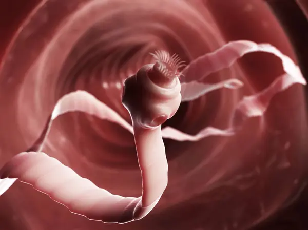 Parasitas da ténia nos intestinos — Fotografia de Stock