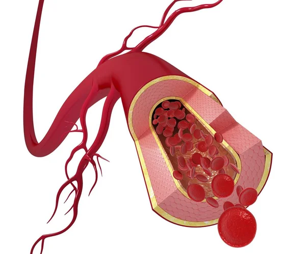 Anatomia tętnic zdrowy — Zdjęcie stockowe