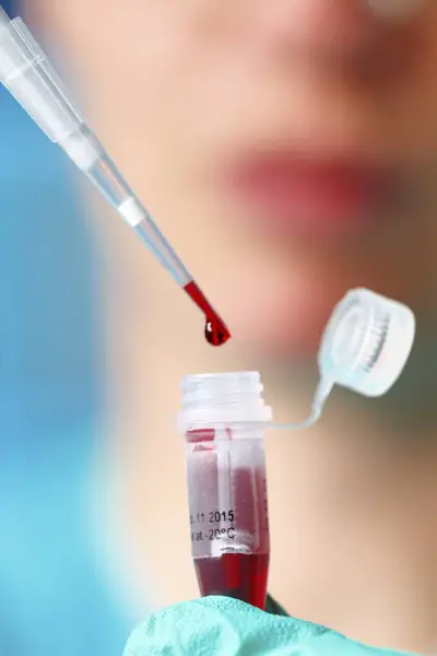 Pipettierblutprobe Nahaufnahme — Stockfoto