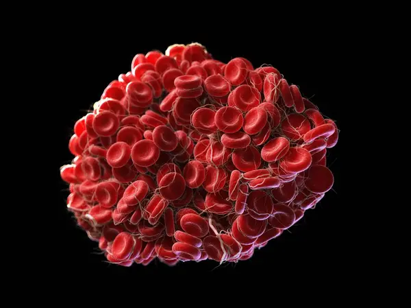 Coagulo di sangue formato da globuli rossi — Foto Stock