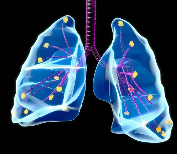 Ludzkie płuca i pęcherzyków płucnych — Zdjęcie stockowe