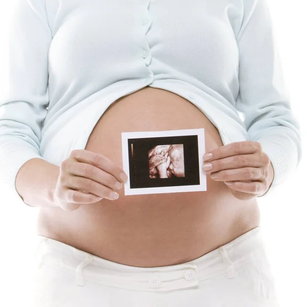 Pregnant Woman Holding Baby Scan Printout — Stock Photo, Image