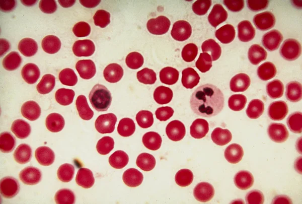 人体红血球 红细胞 的光显微图像 中心附近有两个不明的白细胞 — 图库照片