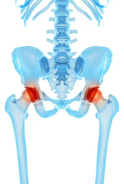 Human hip pain — Stock Photo, Image