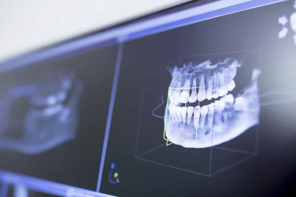 Närbild Tänder Röntgen Tandvårdsklinik — Stockfoto