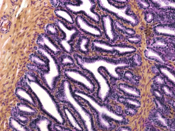 Plegamiento mucoso complejo de la vesícula seminal — Foto de Stock