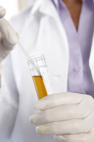 Medisch Werker Gehandschoende Handen Met Test Stok Urine Monsterbuisje — Stockfoto