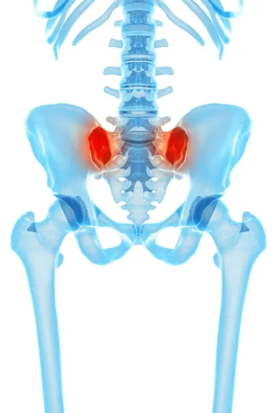 Localizzazione del dolore all'anca — Foto Stock