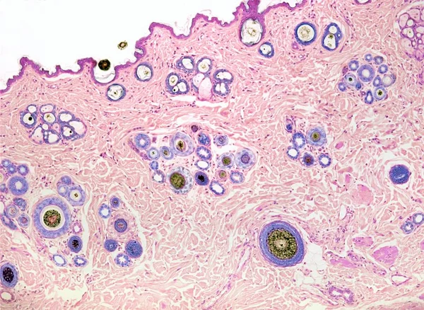 Piel del labio superior con folículos pilosos — Foto de Stock