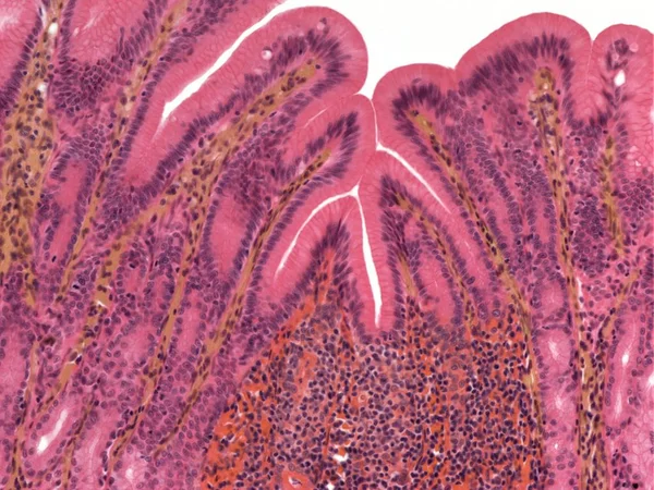 Revestimento do estômago e células mucosas — Fotografia de Stock