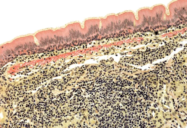 Trachea dilapisi dengan ciliated columnar epithelium — Stok Foto