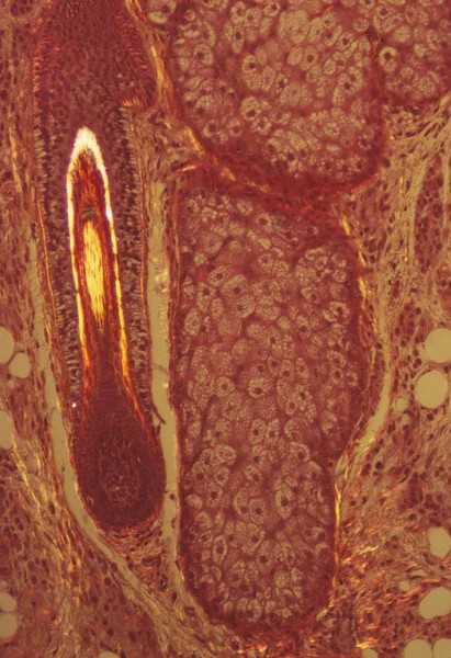 Haarfollikel und Schweißdrüse — Stockfoto