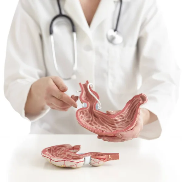 Arzt Mit Medizinischem Modell Des Menschlichen Magens Mit Magenband — Stockfoto