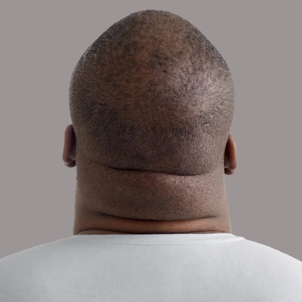 Nahaufnahme Des Übergewichtigen Mannes Hals Rückansicht — Stockfoto