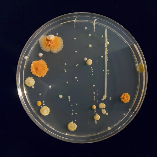 Microbiologische Cultuur Groeien Petrischaal Close — Stockfoto