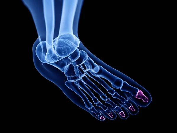 Distal Phalanx Bones Ray Computer Illustration Human Foot — Stock Photo, Image