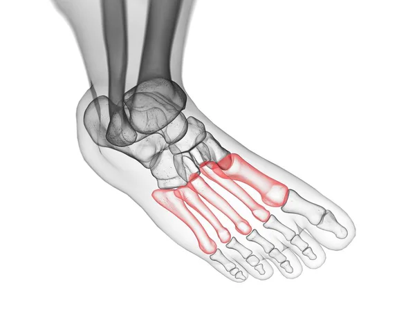 Metatarsal Bones Ray Computer Illustration Human Foot — Stok fotoğraf