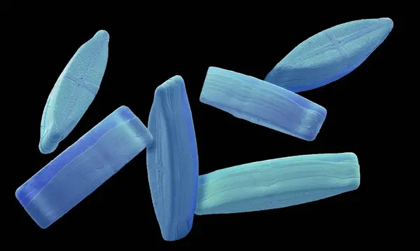 Diatomların Renkli Elektron Mikro Grafiği Fotosentetik Tek Hücreli Algler — Stok fotoğraf