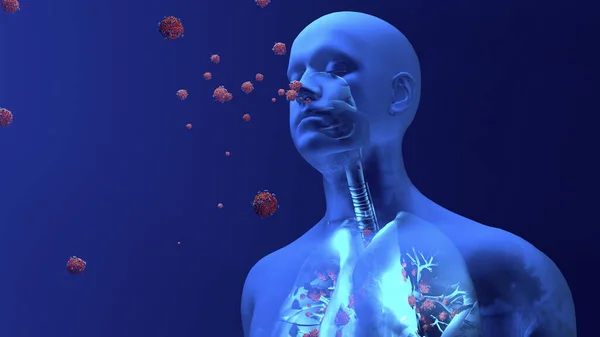 ヒト肺に入るコロナウイルス粒子の概念図 — ストック写真