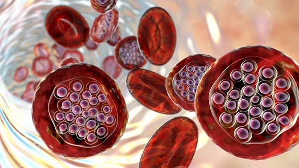 Plasmodium Falciparum Protozoan 적혈구 컴퓨터 — 스톡 사진