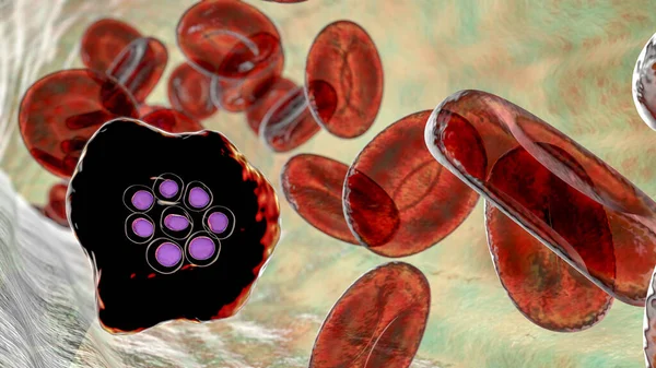 Овальный Пузырь Внутри Красных Кровяных Клеток Стадии Шизофрении Компьютерная Иллюстрация — стоковое фото