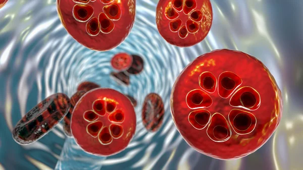 Protozoos Plasmodium Malariae Dentro Los Glóbulos Rojos Etapa Esquizontes Ilustración — Foto de Stock