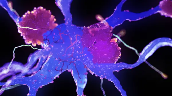 Alzheimer Sinir Hücreleri Bilgisayar Çizimleri — Stok fotoğraf