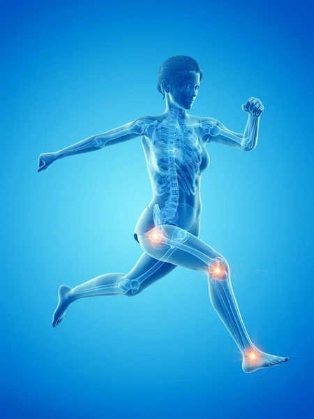 Woman Painful Joints While Running Computer Illustration — Stock Photo, Image