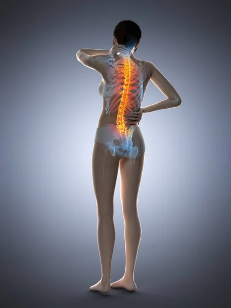 Mujer Con Dolor Espalda Ilustración Por Ordenador —  Fotos de Stock