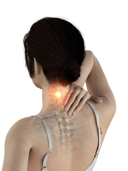 Woman Painful Neck Computer Illustration — Stock Photo, Image