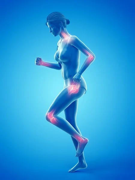 Woman Painful Joints While Walking Computer Illustration — Stock Photo, Image