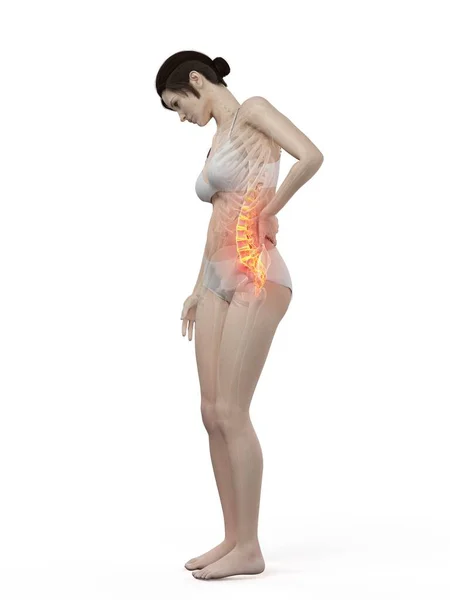 Woman Painful Back Computer Illustration — Stock Photo, Image