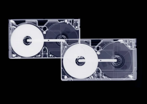 Twee Videocassettes Röntgenfoto — Stockfoto