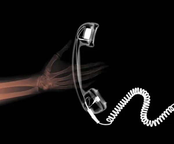 Menschliche Hand Und Telefon Farbiges Röntgenbild — Stockfoto