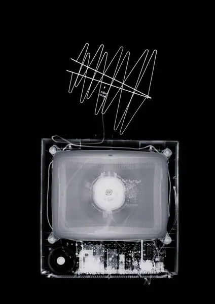 Телевизор Внутренняя Антенна Рентгеновские Лучи — стоковое фото