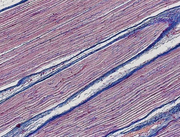 Nervo sciatico umano — Foto stock